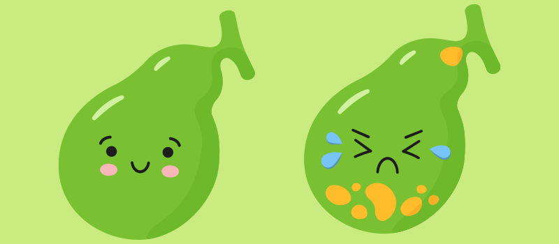 two cartoon gallstones one with a smiling face and the other is sad