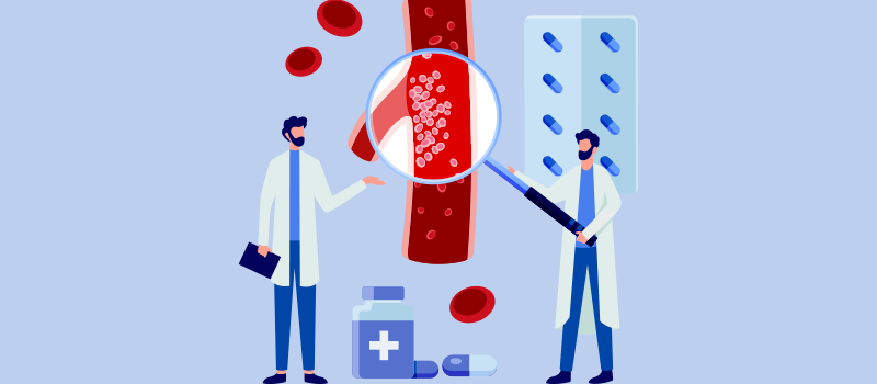 Deep Vein Thrombosis - Lab Medica