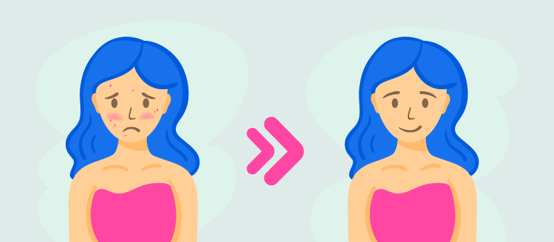 cartoon girl with acne on the left and then no acne on the right