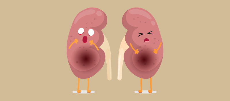 two cartoon kidneys in pain