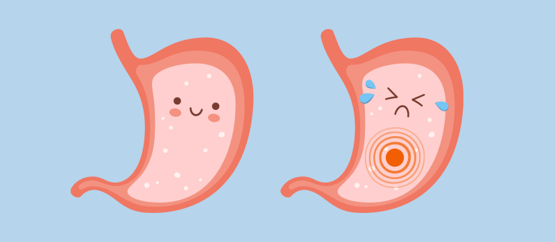 A cartoon of a stomach ulcer.